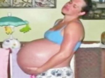 32χρονη έγκυος περίμενε δίδυμα αλλά η κοιλιά της δεν σταματούσε να μεγαλώνει – Ο γυναικολόγος της δεν φανταζόταν κάτι τέτοιο (Video)