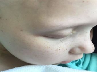 Ένας μπαμπάς φωτογραφίζει την τελευταία βλεφαρίδα της κορούλας του που κάνει χημειοθεραπείες δίνοντας την πιο δύσκολη μάχη της
