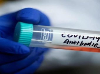 Μετά τον εμβολιασμό πρέπει να κάνω το τεστ αντισωμάτων; – Τι λένε οι ειδικοί -Έρχεται νέο κύμα πανδημίας μετά το καλοκαίρι