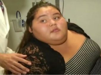 15χρονη μπήκε στο χειρουργείο ως η πιο παχύσαρκη έφηβη του κόσμου. 9 μήνες αργότερα… Δείτε πως έγινε και θα τρίβετε τα μάτια σας (Video)