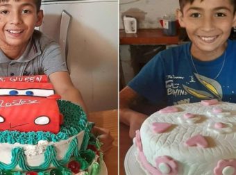 Παιδί 10 ετών με σοβαρά εγκαύματα φτιάχνει γλυκά για να πληρώσει τις θεραπείες του