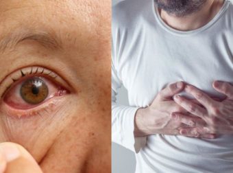 Κορωνοϊός: Τα 8 ύποπτα συμπτώματα που δείχνουν ότι νόσησες και δεν το κατάλαβες