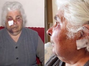 Αιγάλεω: Ηλικιωμένη έζησε την απόλυτη φρίκη στα χέρια ληστών, της έσκισαν τα αυτιά για να της πάρουν τα σκουλαρίκια