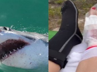 Καρχαρίας δάγκωσε γυναίκα στο πόδι – Δεν φαντάζεστε τι έκανε για να σωθεί (video)