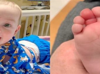 Αδιανόητο: 5 μηνών μωράκι κινδύνευσε από τρίχα να χάσει το δάχτυλο σου
