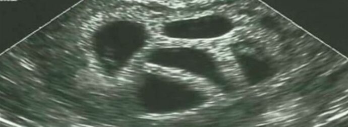 Μια έγκυος γυναίκα αγνόησε τις συμβουλές του γιατρού να κάνει έκτρωση… 20 χρόνια αργότερα δημοσιεύει αυτό!