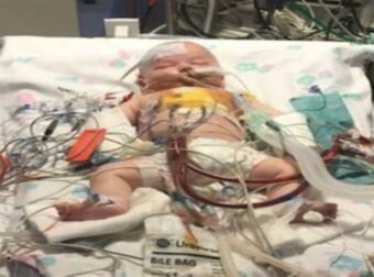 Η καρδιά ενός μωρού σταμάτησε για 15 ώρες – 9 μήνες μετά … (Video)