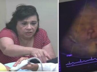 Πήγε για υπερηχογράφημα την έγκυο ανιψιά της – Μόλις όμως κοίταξε την oθόνη έπαθε το σοκ της ζωής της (Video)