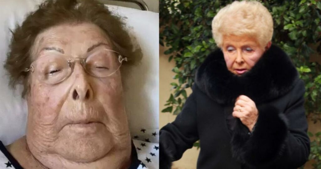 «Την εγκατέλειψαν όλοι»: Δυστυχώς, έγινε γνωστό για την 90χρονη Βέφα Αλεξιάδου, περνάει πολύ δύσκολες μέρες