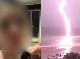 Σoκάρει ο ιατροδικαστής για τη νεκρή 13χρονη: “Αυτό που είχε στο μαγιό, τράβηξε τον κεραυνό” – Γονείς προσοχή