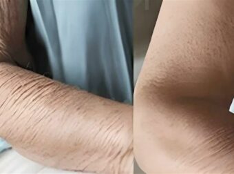 Πώς να φροντίσετε το δέρμα που γερνάει – Τα λάθη που κάνουμε και μας μεγαλώνουν