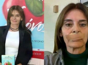 Πλουμιδάκη: Υποβλήθηκε στο 21ο χειρουργείο – «Πήραν λίπος από τον γλουτό για τη συγκεκριμένη επέμβαση»