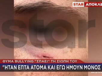 Άγριο ξύλο σε 14χρονο μαθητή για… μια λάθος πάσα στο μπάσκετ – Είχαν δείρει και τον αδελφό του (video)