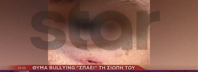 Άγριο ξύλο σε 14χρονο μαθητή για… μια λάθος πάσα στο μπάσκετ – Είχαν δείρει και τον αδελφό του (video)
