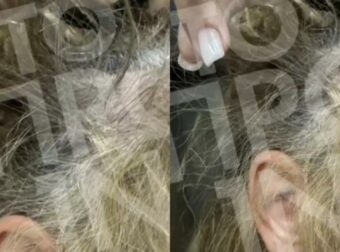Δάφνη: Ποινική δίωξη στον πλαστικό χειρουργό που ξυλοκόπησε 43χρονη οδηγό