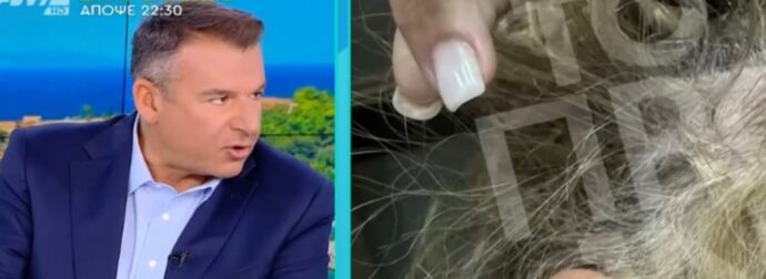 Γνωστός πλαστικός χειρουργός ξυλοκόπησε στη μέση του δρόμου 43χρονη