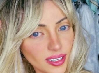 Θλίψη στη Βραζιλία: Νεκρή influencer που έκανε 27 πλαστικές επεμβάσεις για να μοιάσει στη Barbie