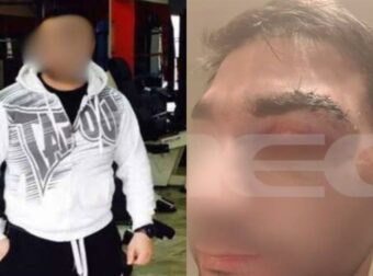 ΕΚΤΑΚΤΟ: Νεκρός ο μποξέρ που ξυλοκόπησε τον γιατρό μέσα στο νοσοκομείο